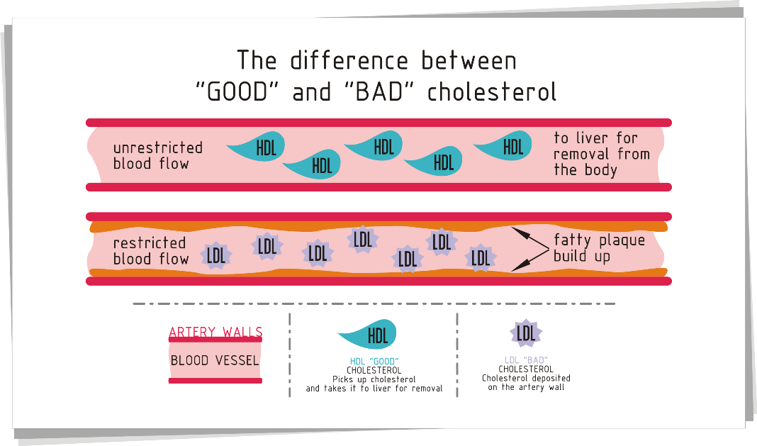 cholesterol